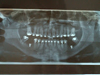 Oral Sin Implantes Maceió