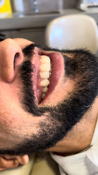 Dra. Michelle Cavalcante | Lentes de Contato Dental | Implante Dentário | Dentista em Maceió