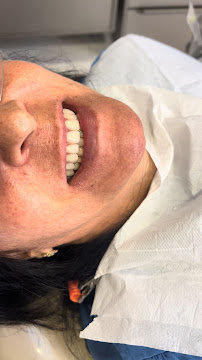 Dra. Michelle Cavalcante | Lentes de Contato Dental | Implante Dentário | Dentista em Maceió