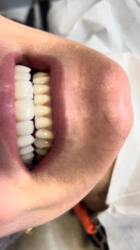 Dra. Michelle Cavalcante | Lentes de Contato Dental | Implante Dentário | Dentista em Maceió