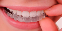 Dra. Michelle Cavalcante | Lentes de Contato Dental | Implante Dentário | Dentista em Maceió
