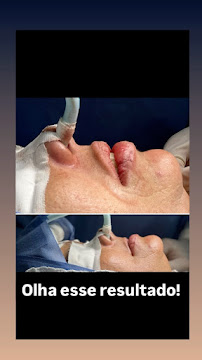 Clínica Odontológica Dr. Marcus Brêda em Jatiúca Maceió, Plano De Saúde, Extração do Siso, Implante Dentário, Cirurgia