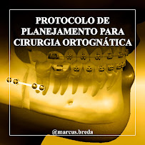 Clínica Odontológica Dr. Marcus Brêda em Jatiúca Maceió, Plano De Saúde, Extração do Siso, Implante Dentário, Cirurgia