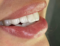 Odontologia Integrada Natal | Implante sem corte, sem dor e resultado imediato | Dentista em Natal/RN