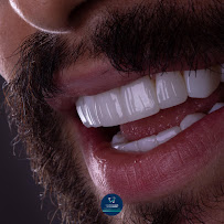 Odontologia Integrada Natal | Implante sem corte, sem dor e resultado imediato | Dentista em Natal/RN
