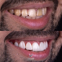 Odontologia Integrada Natal | Implante sem corte, sem dor e resultado imediato | Dentista em Natal/RN