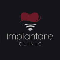 Implantare Clinic Natal-RN - Clínica Odontológica Especializada em Implantes Dentários e Próteses