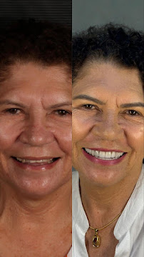 Implantare Clinic Natal-RN - Clínica Odontológica Especializada em Implantes Dentários e Próteses