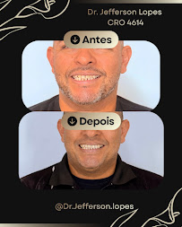 Dr. Jefferson Lopes | Dentista em Natal - prótese, implante dentário, clareamento dental, facetas. Clínica odontológica.