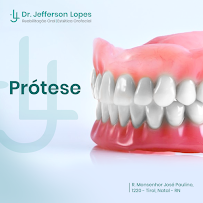 Dr. Jefferson Lopes | Dentista em Natal - prótese, implante dentário, clareamento dental, facetas. Clínica odontológica.