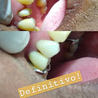 Dr. Jefferson Lopes | Dentista em Natal - prótese, implante dentário, clareamento dental, facetas. Clínica odontológica.