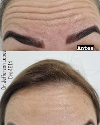 Dr. Jefferson Lopes | Dentista em Natal - prótese, implante dentário, clareamento dental, facetas. Clínica odontológica.