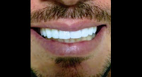 Dr. Jefferson Lopes | Dentista em Natal - prótese, implante dentário, clareamento dental, facetas. Clínica odontológica.
