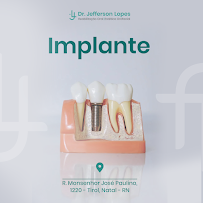 Dr. Jefferson Lopes | Dentista em Natal - prótese, implante dentário, clareamento dental, facetas. Clínica odontológica.