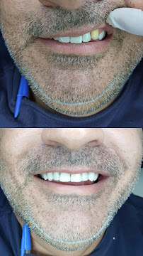 Dr. Jefferson Lopes | Dentista em Natal - prótese, implante dentário, clareamento dental, facetas. Clínica odontológica.