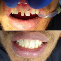 Dr. Jefferson Lopes | Dentista em Natal - prótese, implante dentário, clareamento dental, facetas. Clínica odontológica.