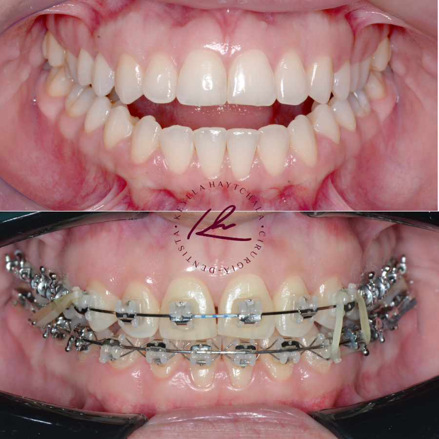 Dental Clinic Le Blanc Odontologia dental clinic in Natal