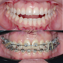 Le Blanc Odontologia Dental Clinic in Natal