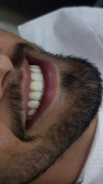 Le Blanc Odontologia+