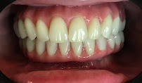Fonsêca Odontologia | Implantes