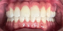 Fonsêca Odontologia | Implantes