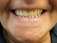 Fonsêca Odontologia | Implantes