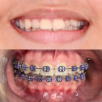 Odonto Vitta - Clínica Odontológica em Natal/RN