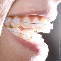 Odonto Vitta - Clínica Odontológica em Natal/RN