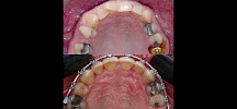 Robson André | Dentista