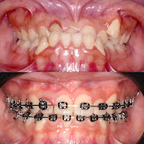 Robson André | Dentista