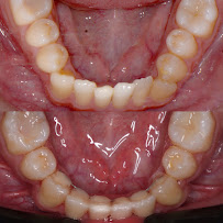 Robson André | Dentista