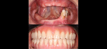 Robson André | Dentista