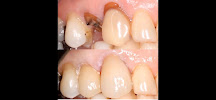 Robson André | Dentista