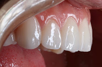 Robson André | Dentista