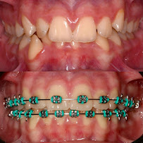Robson André | Dentista