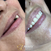 Maxx Odontologia | Implante Dentário | Dentistas