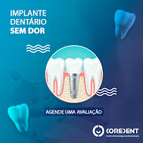 Coredent Centro Odontológico | Implantes dentários em Campo Grande | dentista em Campo Grande