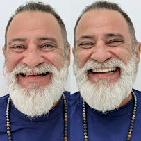 Líder Odontologia - Campo Grande, Implantes dentários, Próteses, Alinhadores