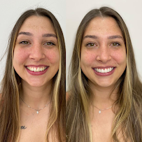 Líder Odontologia - Campo Grande, Implantes dentários, Próteses, Alinhadores