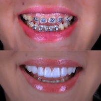 Clínica LK – Dra. Lais Carolina | Clínica Geral, Lentes de Resina, Harmonização Facial, Lipo de Papada, Bichectomia, Botox.