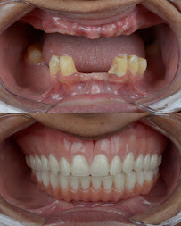 Dentista - Instituto Face a Face - Clínica Odontológica completa