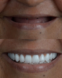 Dentista - Instituto Face a Face - Clínica Odontológica completa