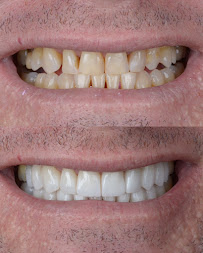 Dentista - Instituto Face a Face - Clínica Odontológica completa
