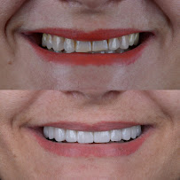 Dentista - Instituto Face a Face - Clínica Odontológica completa
