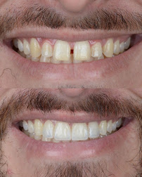 Dentista - Instituto Face a Face - Clínica Odontológica completa