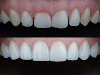 Dentista - Instituto Face a Face - Clínica Odontológica completa