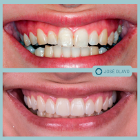 Dr. José Olavo | Dentista | Prótese - Implante - Lente de Contato Dental - Campo Grande