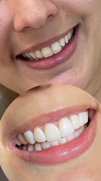 Dentista Giordana Oliveira | Especialista em Odontologia Estética Campo Grande/MS