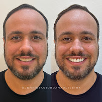 Dentista Giordana Oliveira | Especialista em Odontologia Estética Campo Grande/MS