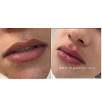 Dentista Giordana Oliveira | Especialista em Odontologia Estética Campo Grande/MS
